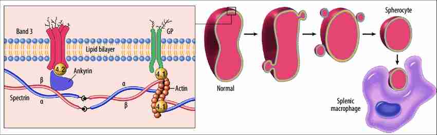 Formation of spherocytes.