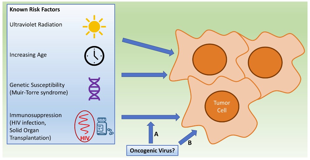 Analysis of possible causative factors of sebaceous carcinoma.