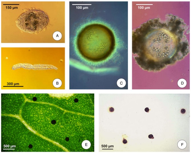 Stages of the Fasciola hepatica life cycle involved in human infection.