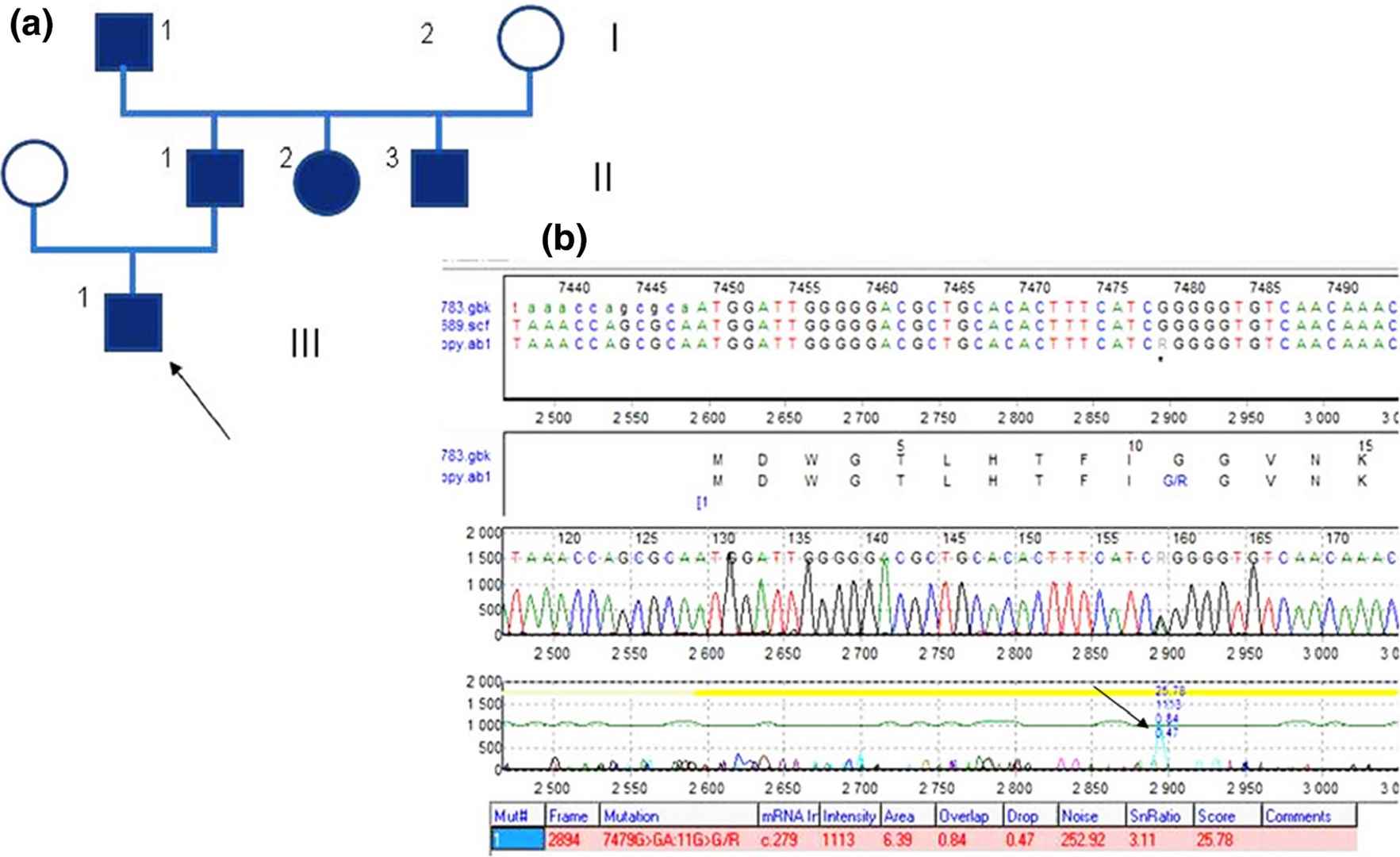 Polish Clouston family pedigree and GJB6 gene exon 1 analysis results.