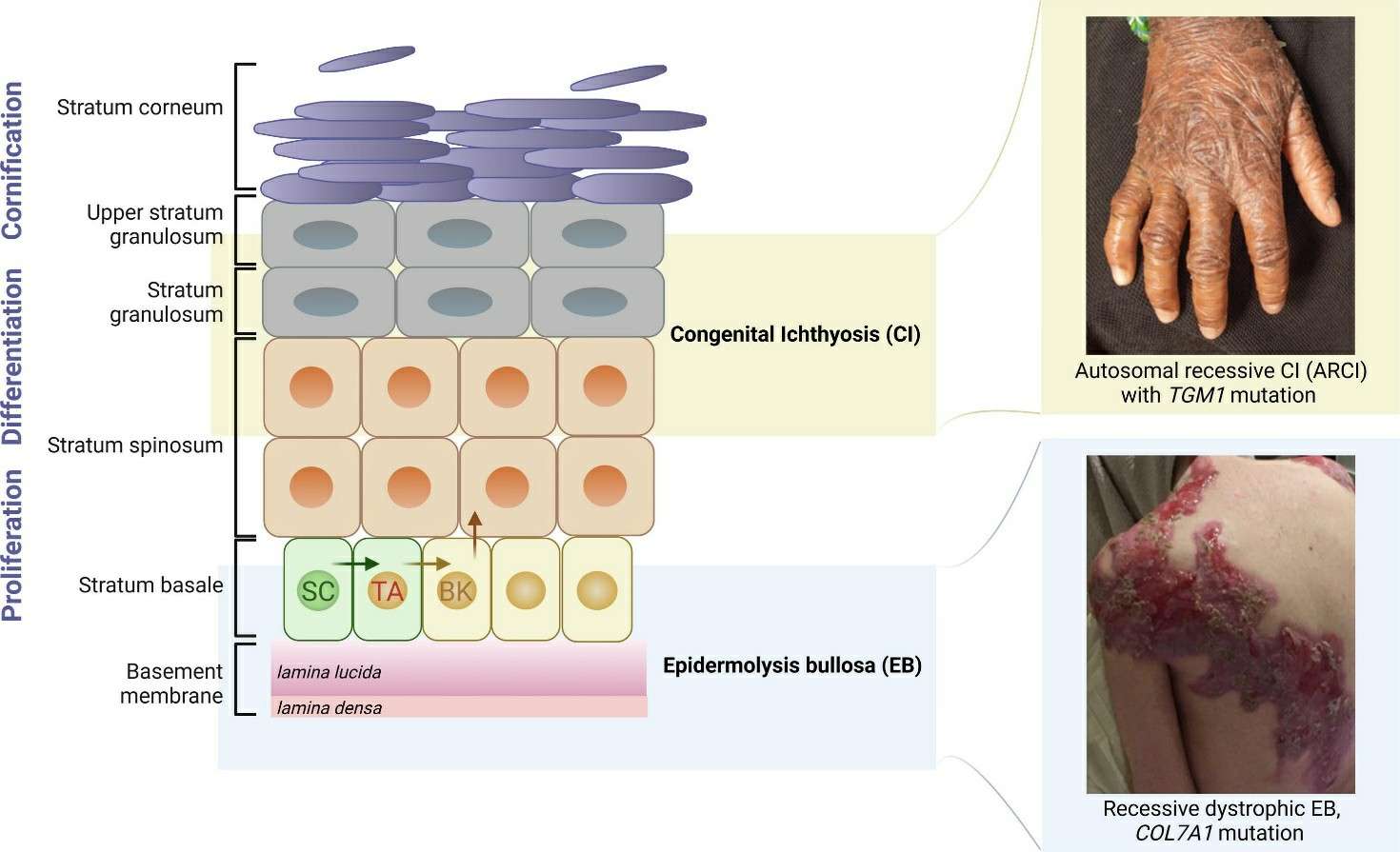 The skin structure and genodermatoses.