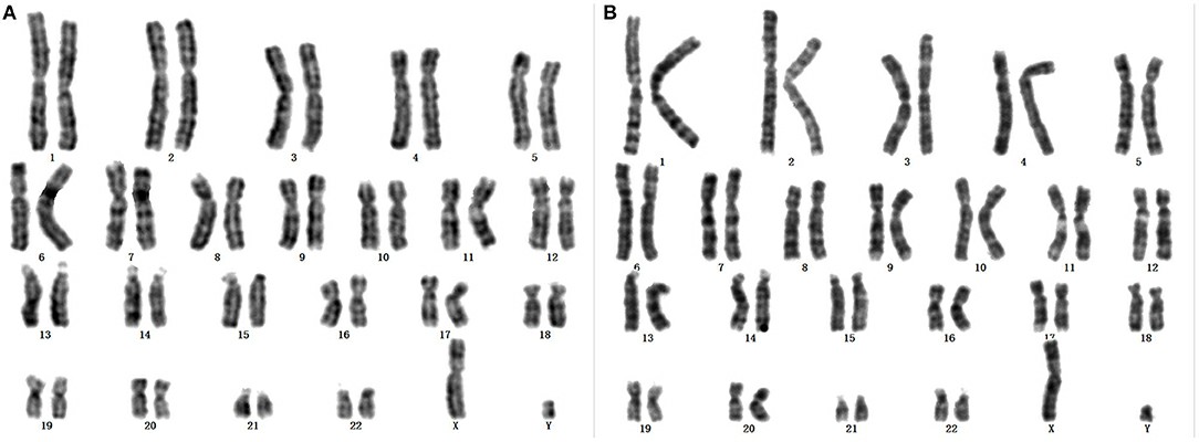 2. Karyotype Analysis Service-1